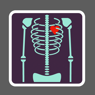 Illustration of an X ray showing a heart